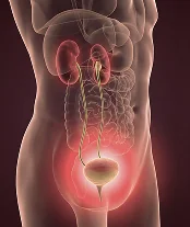 반복되는 여성질환 치료 일러스트