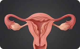 자궁내막증식증 안내