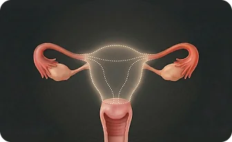 자궁 적출 수술 후 후유증 치료