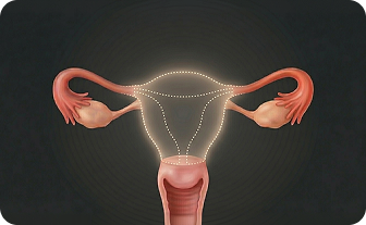 자궁 적출 수술 후 후유증 치료